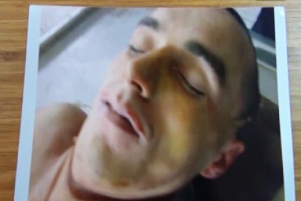 ლევან იზორიამ წამებით მოკლული კიდევ ერთი პატიმრის შემზარავი ფოტომსალა გამოაქვეყნა