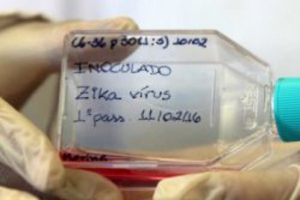 აშშ-ში დაახლოებით 300 ფეხმძიმე ქალს ზიკას ვირუსი აღმოაჩნდა