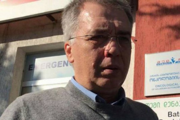 დავით სერგეენკომ ბათუმში სასტუმრო „ლეოგრანდში“ ხანძრის შედეგად დაშავებულები მოინახულა