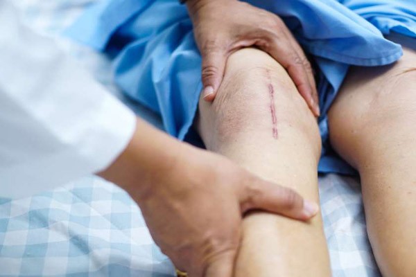 ინგლისში ქირურგებმა მარჯვენა მუხლის სახსრის პროთეზი პაციენტს შეცდომით მარცხენა ფეხზე დაუყენეს