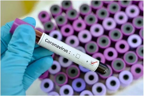 საქართველოში კორონავირუსით ინფიცირების შემთხვევათა რაოდენობა 73-მდე გაიზარდა