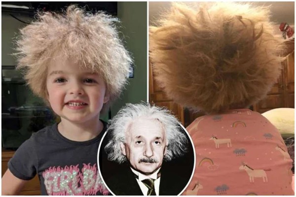 ალბერტ აინშტაინის ვარცხნილობამ ბავშვს პოპულარობა მოუტანა