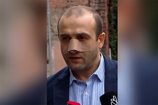 იაგო ხვიჩიას ფიზიკური შეურაცხყოფა მიაყენეს