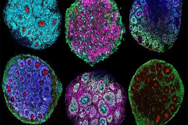 ისტორიაში პირველად, მეცნიერებმა რამდენიმე ადამიანის უჯრედებისგან 3D მინიტვინები შექმნეს