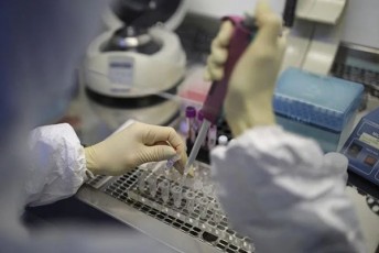 bolo-informaciiT-axali-koronavirusisgan-msoflioSi-63-662-adamiani-ganikurna