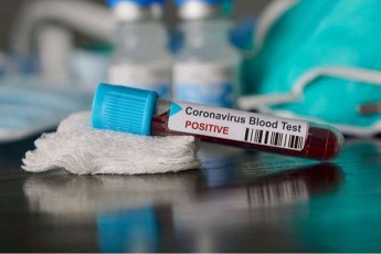 saqarTveloSi-koronavirusiT-inficirebis-24-e-SemTxveva-dadasturda