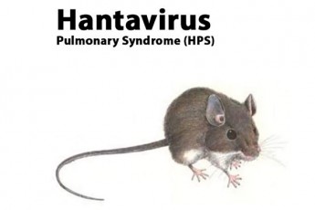 CineTSi-hantavirusis-letaluri-SemTxveva-dafiqsirda-magram-es-axali-pandemiis-safrTxes-ar-warmoadgens