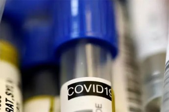 saqarTveloSi-koronavirusiT-inficirebis-SemTxvevaTa-raodenoba-85-mde-gaizarda