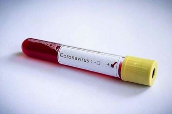mediis-cnobiT-okupirebul-afxazeTSi-koronavirusiT-inficirebis-pirveli-SemTxveva-dafiqsirda