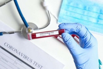 ucnauri-cvlileba-specialur-veb-gverdze-koronavirusiT-dainficirebulTa-raodenoba-Semcirda