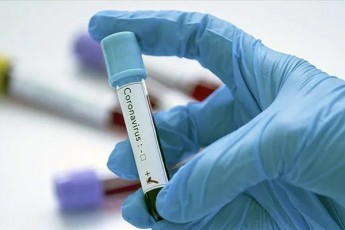 Tbilisis-medicinis-institutis-erT-erT-TanamSromels-koronavirusi-daudasturda