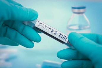 germania-mouwodebs-CineTs-naTeli-mohfinos-koronavirusis-epidemiis-gamomwvev-mizezebs