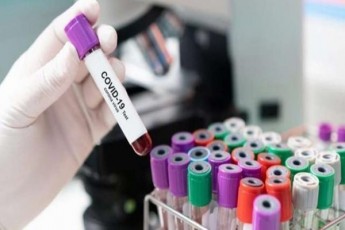 saqarTveloSi-koronavirusiT-gardacvlilTa-ricxvi-5-mde-gaizarda