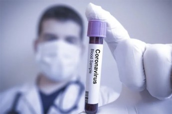 saqarTveloSi-koronavirusiT-inficirebis-SemTxvevaTa-raodenoba-420-mde-gaizarda