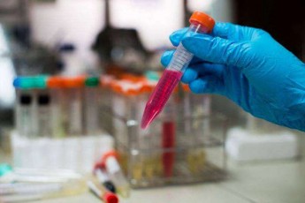 boWoriSvilis-klinikas-dRes-savaraudod-erTi-pacienti-datovebs