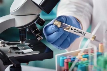 24-saaTSi-koronavirusiT-inficirebis-5-axali-SemTxveva-gamovlinda-14-adamiani-gamojanmrTelda