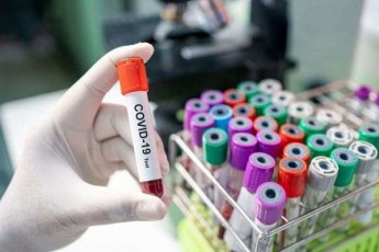 koronavirusis-44-axali-SemTxvevidan-25-aWaraSi-gamovlinda