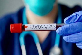 kurieris-informaciiT-qarTlSi-200-kaciani-qorwilis-erT-erT-stumars-koronavirusi-daudasturda