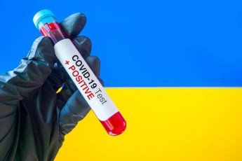 ukrainaSi-koronavirusiT-inficirebulTa-ricxvma-160000-s-gadaaWarba
