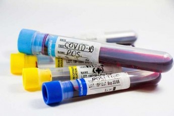 inficirebulebis-90-gadaitans-am-viruss---cnobilma-eqimma-koronavirusi-2-saxeobad-ganacalkeva