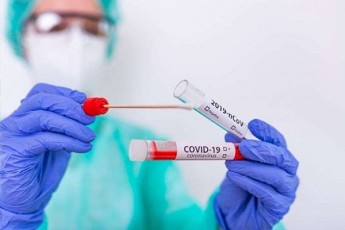 kovidinficirebis-axali-SemTxvevebidan-1-044-TbilisSi-gamovlinda