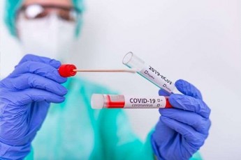 kovidinficirebis-axali-SemTxvevebidan-1-493-TbilisSi-448-ki-aWaraSi-gamovlinda