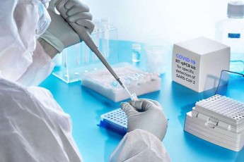 amiran-gamyreliZem-ganmarta-Tu-sad-da-ra-SemTxvevaSi-tardeba-COVID19-is-gamosavlenad-antigenis-testi