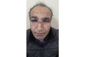 walkis-municipalitetis-sofel-ar-sarvanSi-qarTuli-ocnebis-wevrs-nacmoZraobis-mxardamWerma-fizikuri-Seuracxyofa-miayena