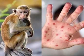 axali-kombinacia-gaiCarxa-maimunis-yvavilis-virusis-sadiagnostikod-saqarTveloSi-specialuri-pisiar-testebi-Semova